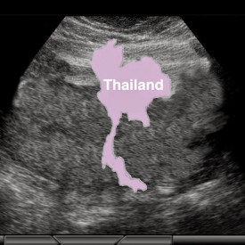 Thailand Adoption