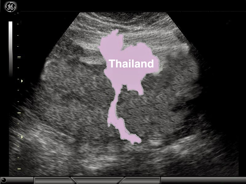 Thailand - Welcome to the World, Baby Girl
